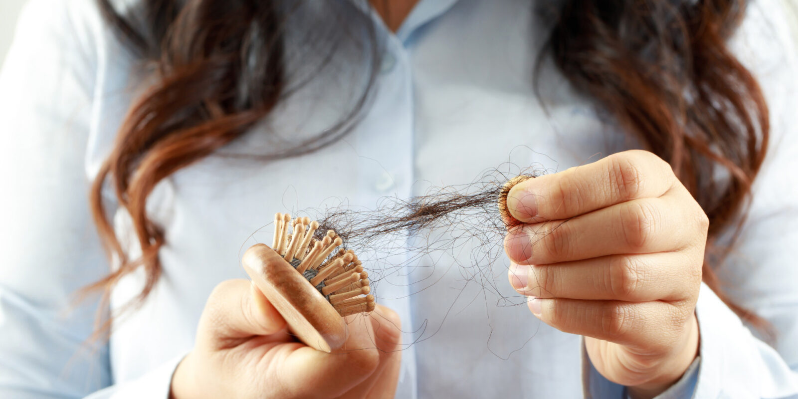 Haarausfall bei Frauen: Ursachen, Behandlungen und Tipps
