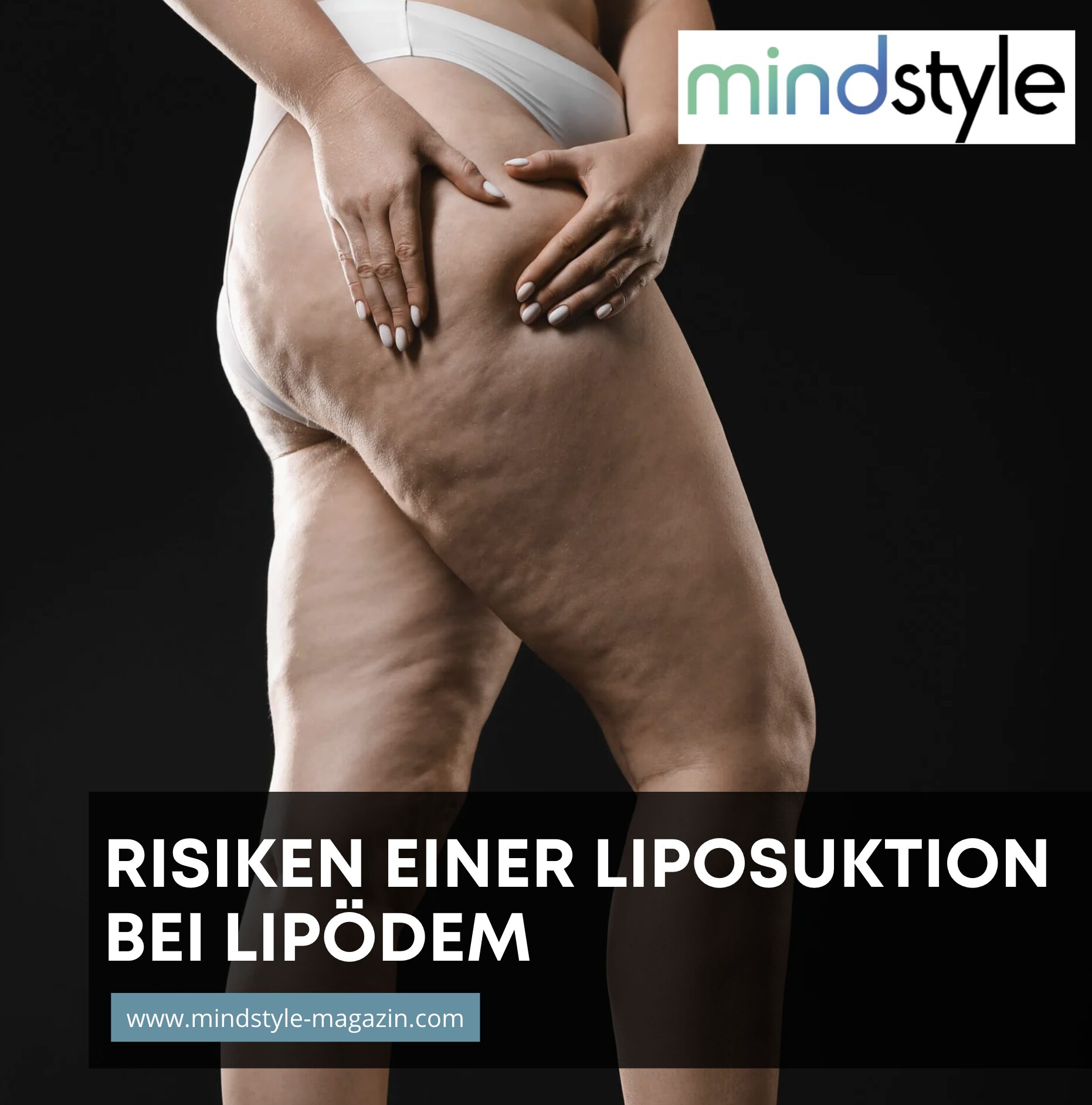 Risiken und Nebenwirkungen einer Liposuktion bei Lipödem Risiken und Nebenwirkungen einer Liposuktion bei Lipödem