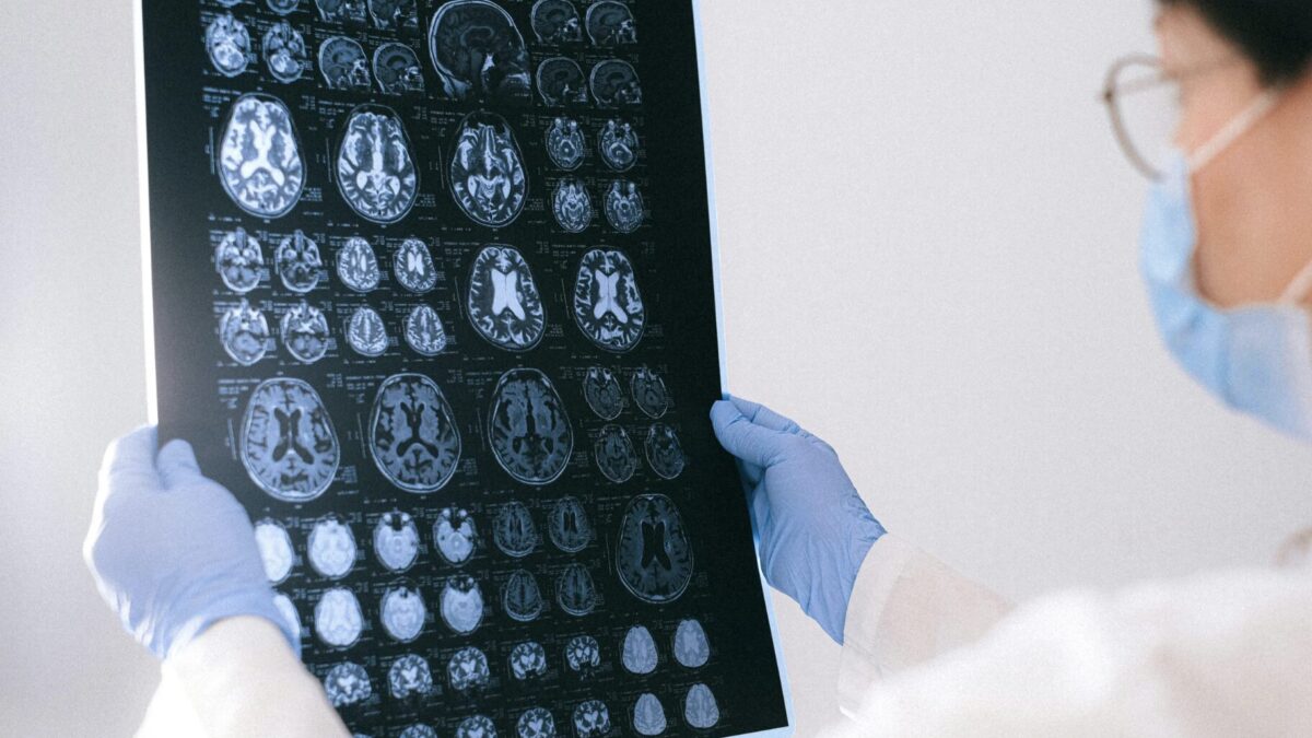 Schädel-Hirn-Traumata