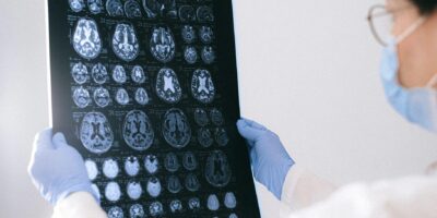 Schädel-Hirn-Traumata