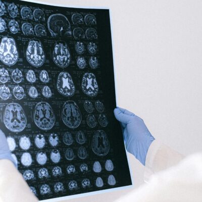 Schädel-Hirn-Traumata